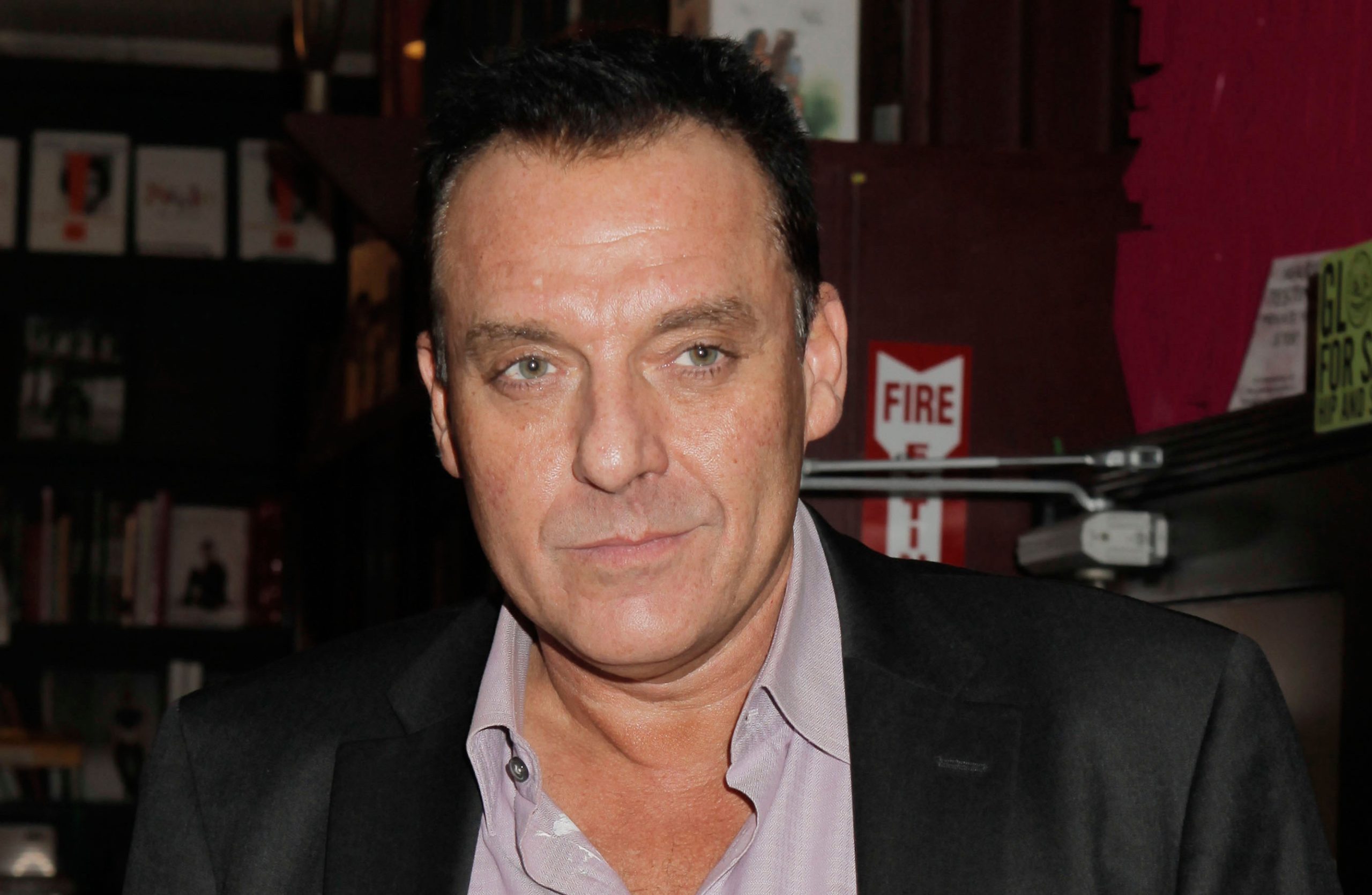 simptomi aneurizme mozga tom sizemore portret