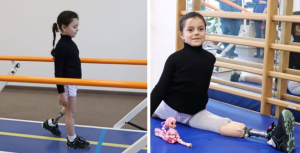 izgubila nogu Oleksandra proteza gimnastika